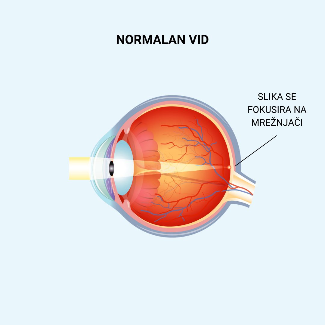 Prelamanje svetlosti u normalnom oku