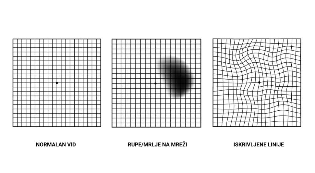 Amslerov test